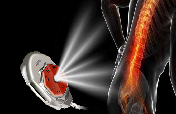 治療腰椎間盤突出方法 治療腰椎間盤突出方法